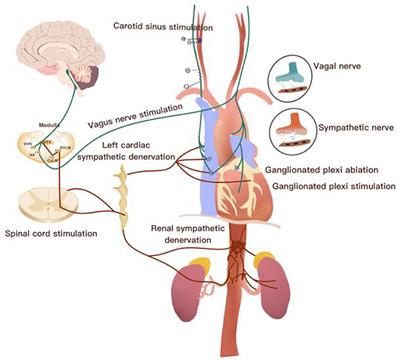 Non-invasive Autonomic Neuromodulation Is Opening New Landscapes for Cardiovascular Diseases